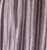 پوست پيازي